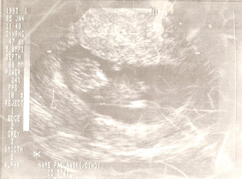 Ultrasound image of child in the womb.   (c) Cindy Paslawski